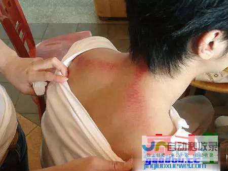 真正刮痧治病不传之秘法：各种瘀滞病症开锁法！_刮痧疗法_高斗养生网_经络穴位_针灸_艾灸_刮痧_推拿按摩
